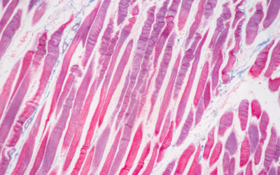 Electrospinning for tissue repair